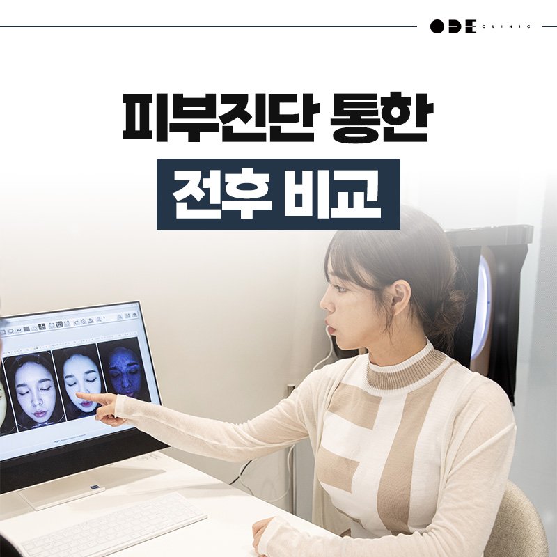 trusted Ultherapy Prime clinic Seoul